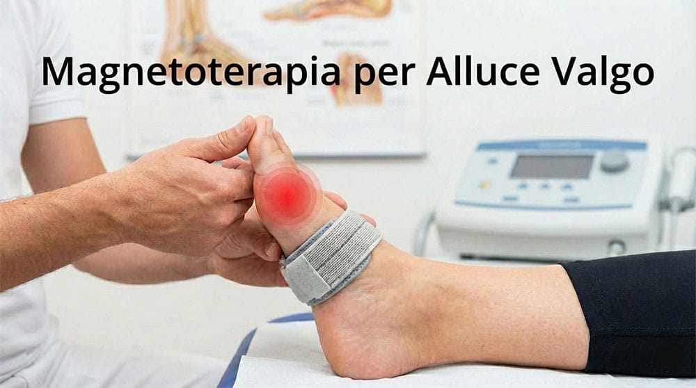 piede con alluce valgo in evidenza
